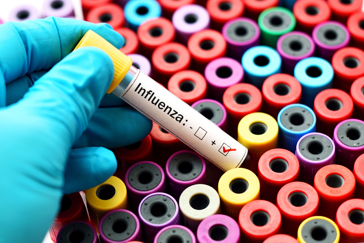 influenza-test-tube