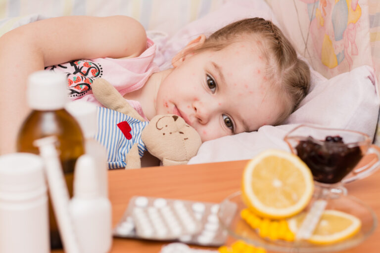 Child with chickenpox laying in bed