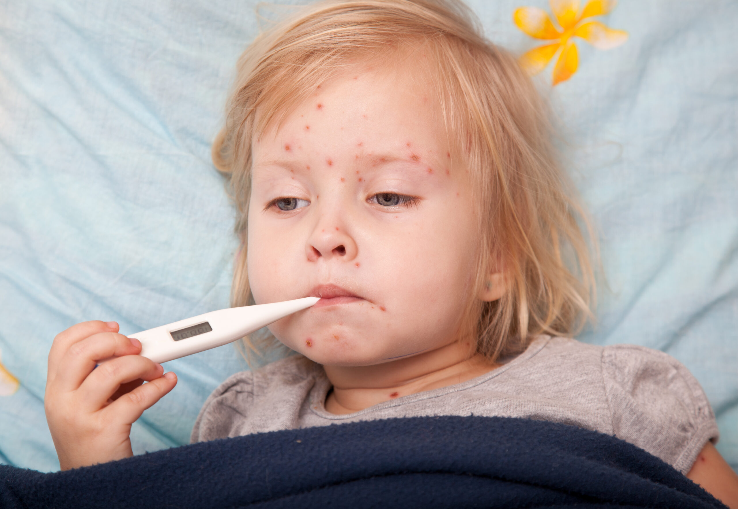 Little girl sick with the measles taking her temperature