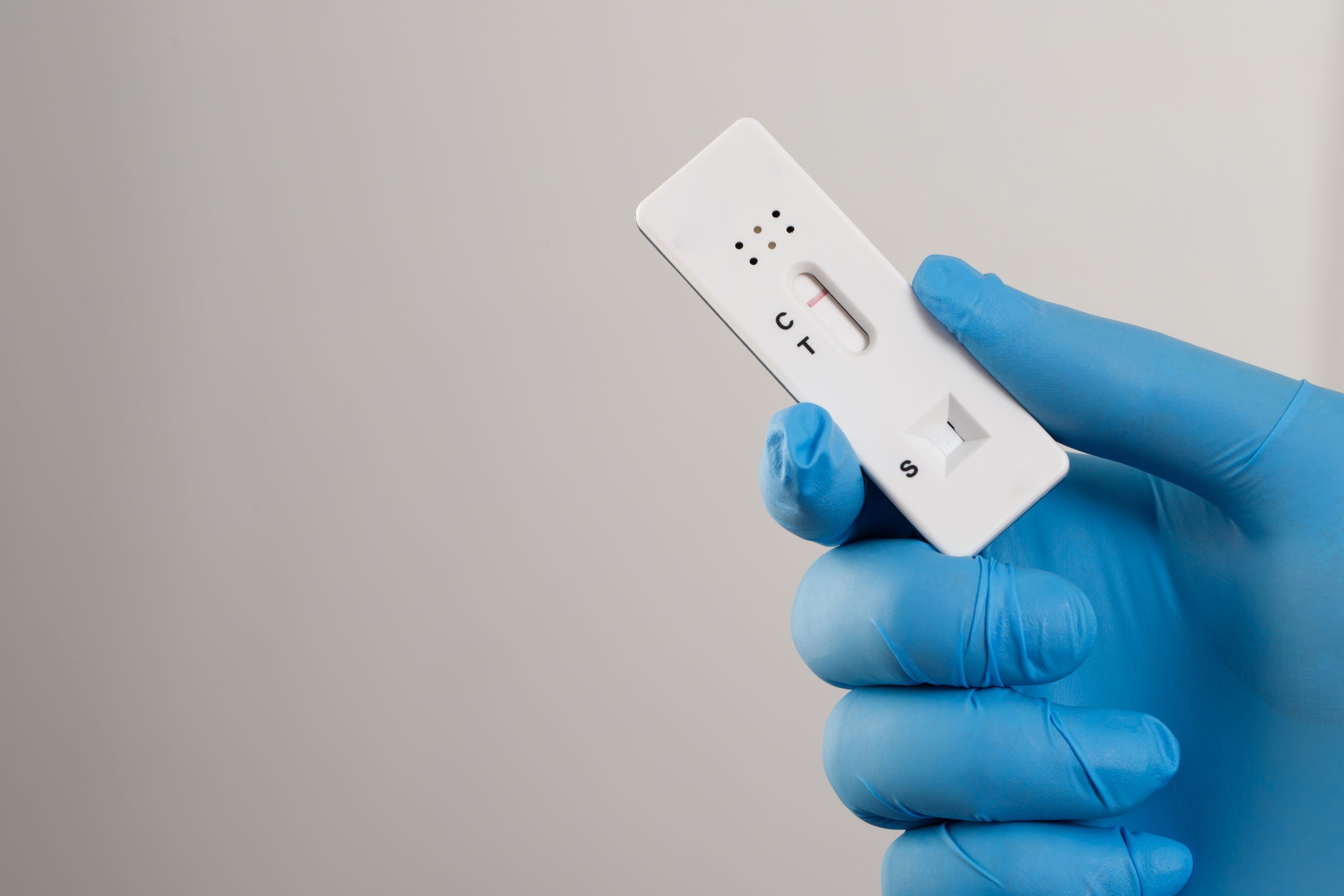 Doctor with Covid-19 test kit from the lab at the hospital