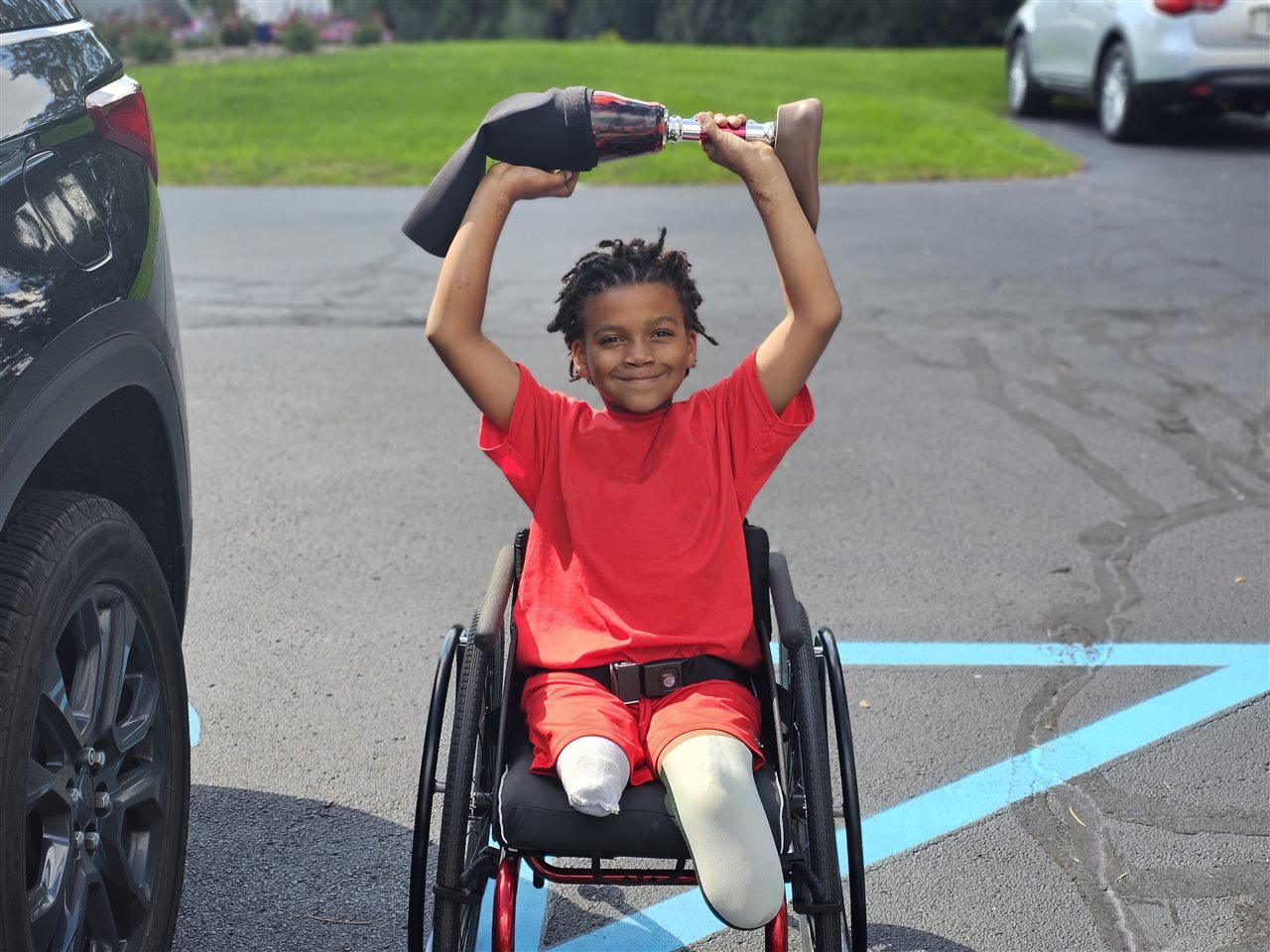 Boy in a wheelchair holding up his prostethic leg